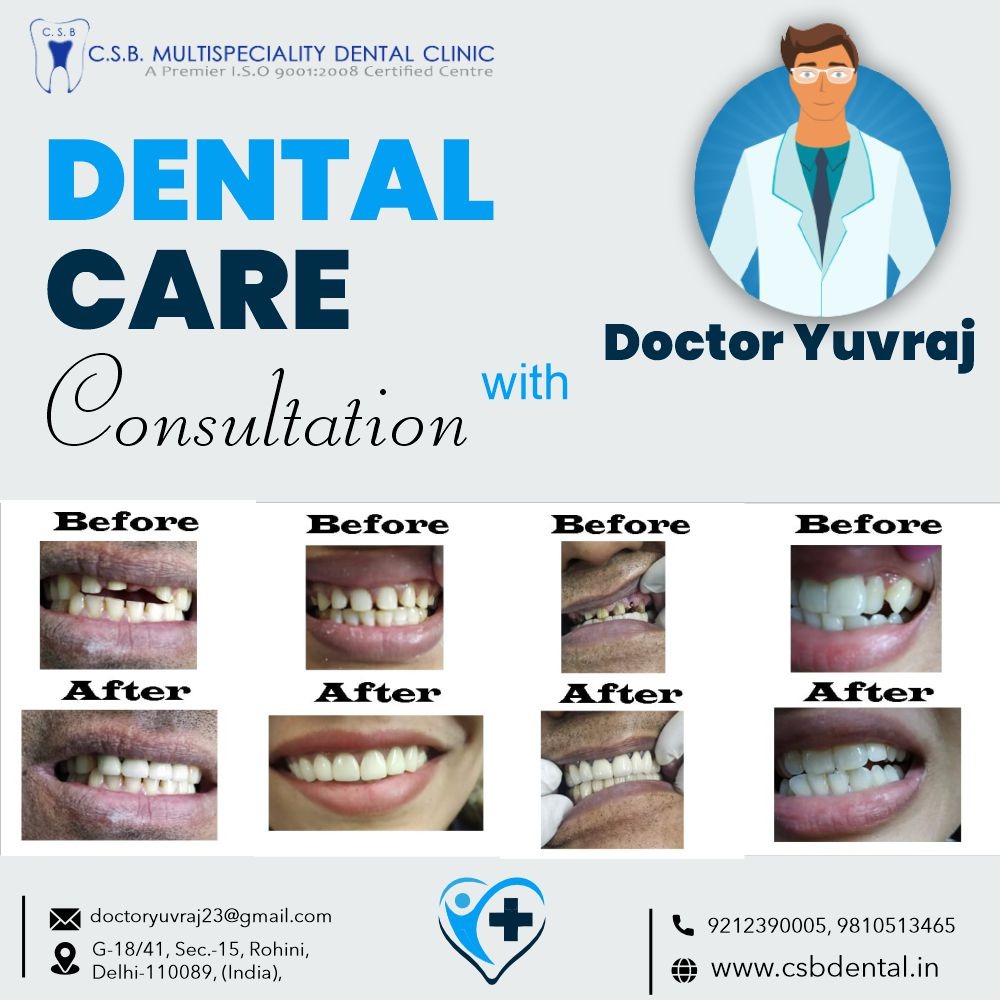 Dental Spa in rohini sector 15, Delhi